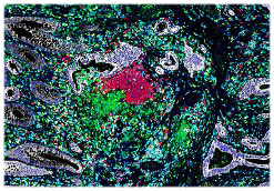 Immunologie et cancérologie.